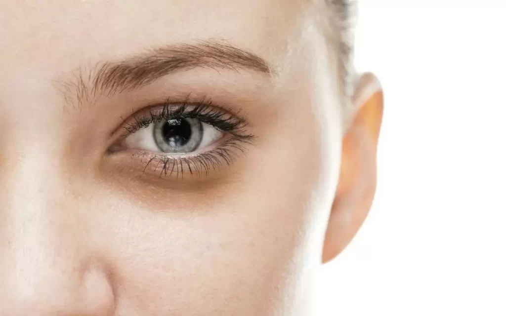پی آر پی یک روش برای رفع تیرگی زیر چشم