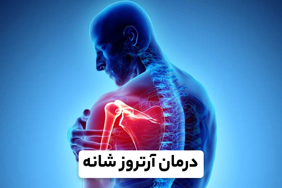 علل بروز آرتروز شانه، نحوه تشخیص و درمان