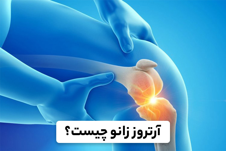 ساییدگی زانو 