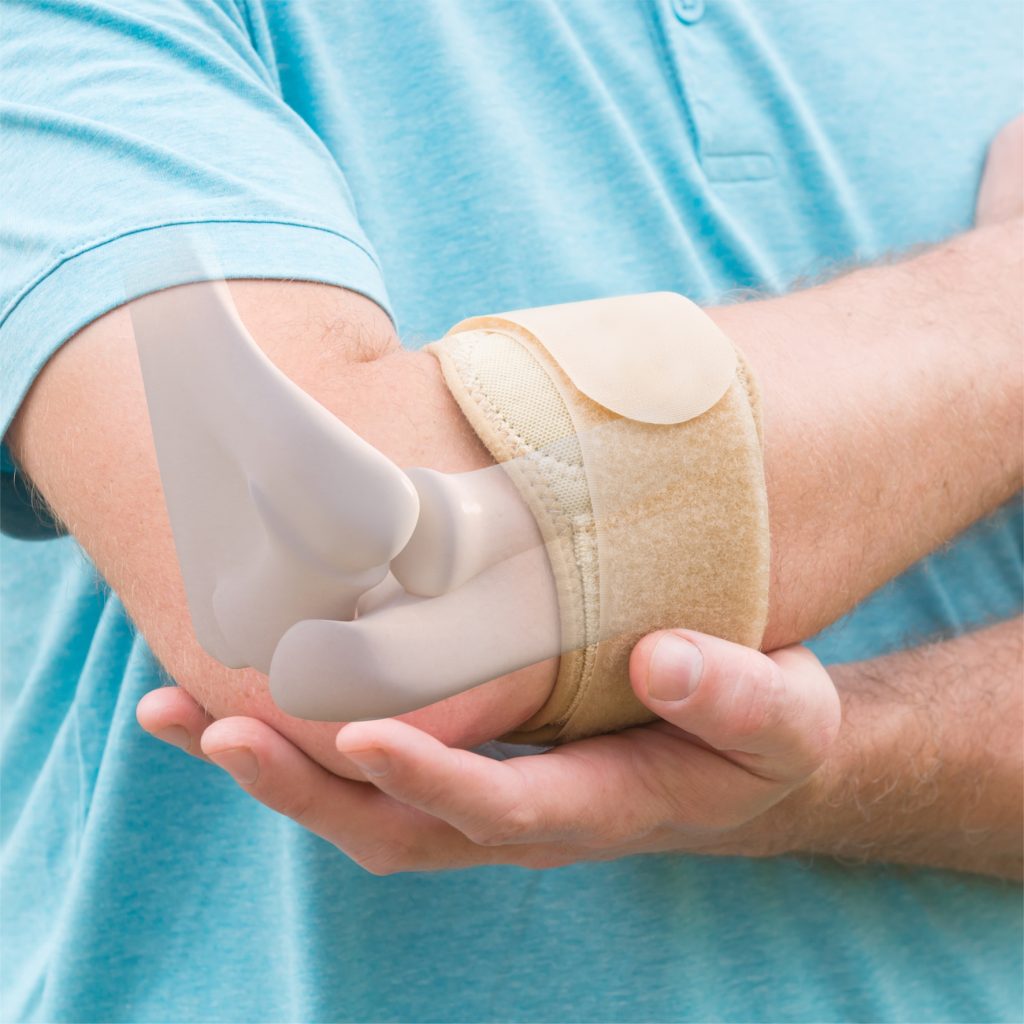 کاربرد PRP در درمان تروماهای عضلانی