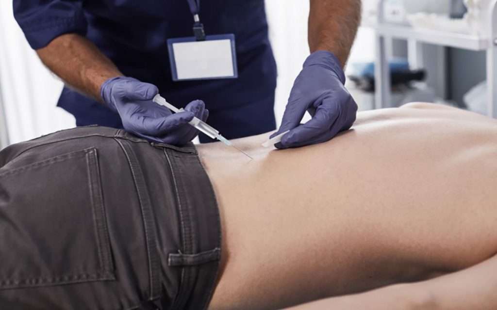 اثرات PRP در بیماران مبتلا به آرتروز زانو و کمر