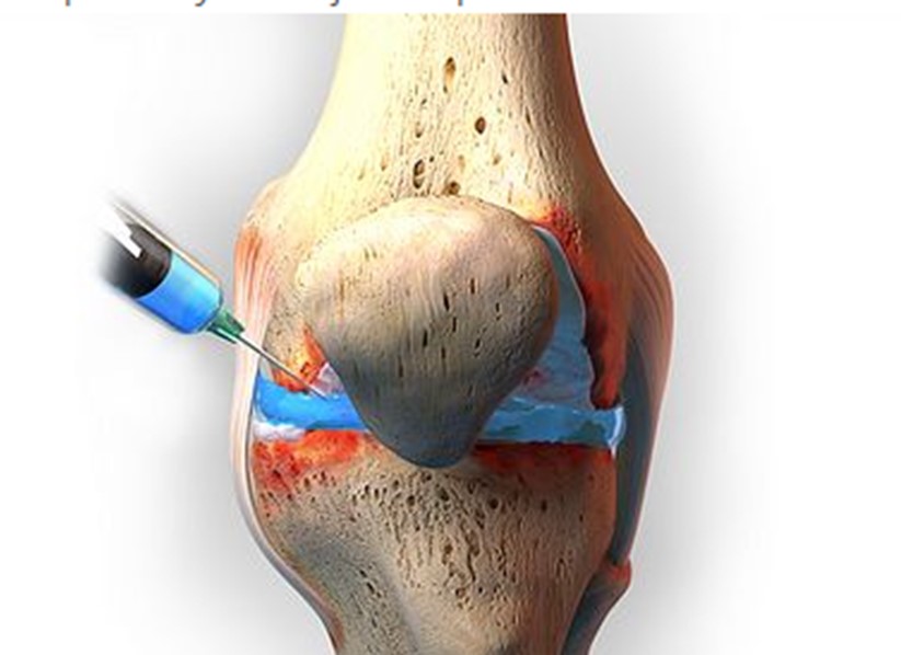 کاربرد PRP در درمان تروماهای عضلانی