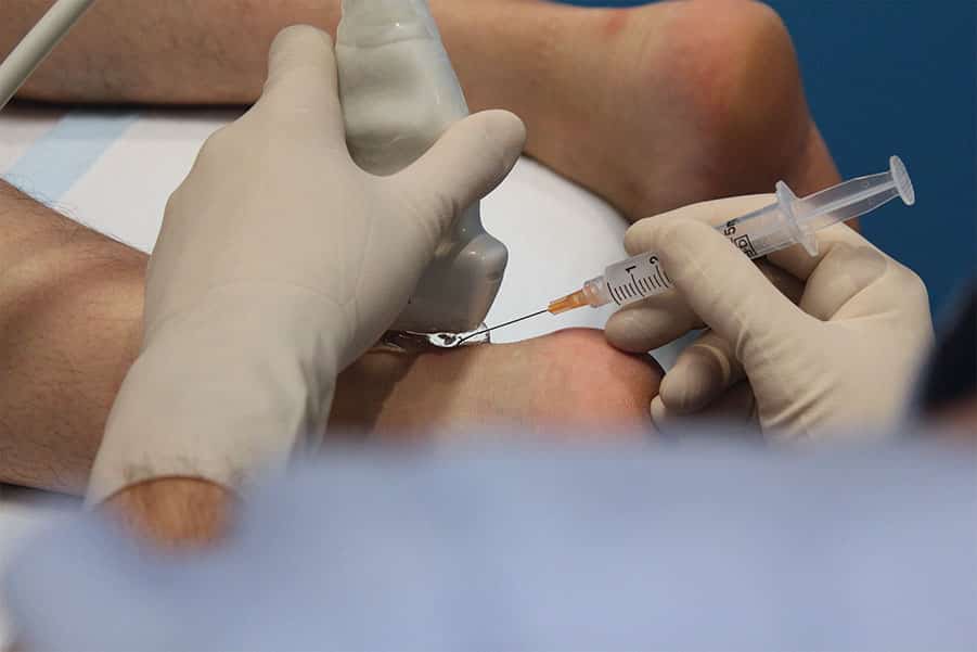 نقش PRP در کاهش نیاز به جراحی‌های تکراری