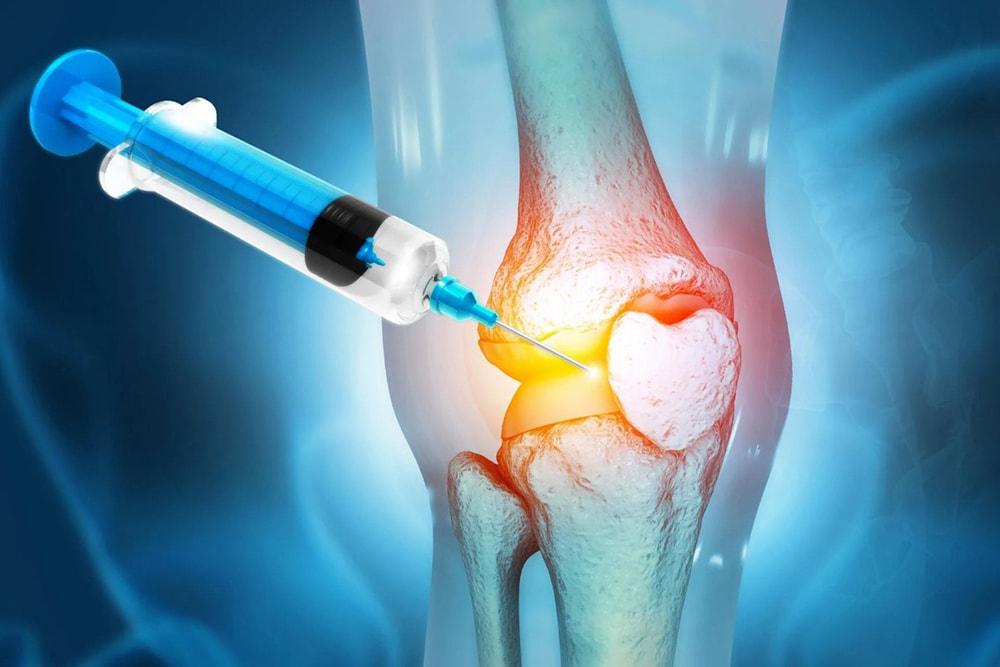 PRP در ترمیم پارگی رباط‌ ها