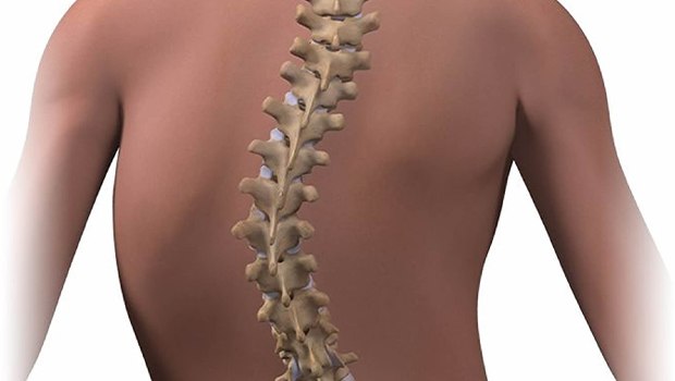 کاربرد PRP در درمان اسکولیوز