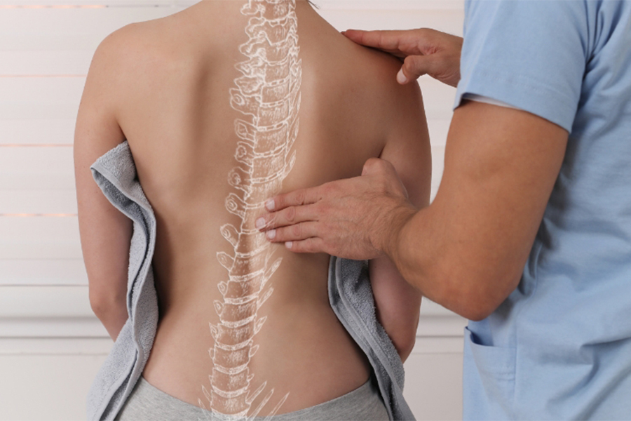 کاربرد PRP در درمان اسکولیوز