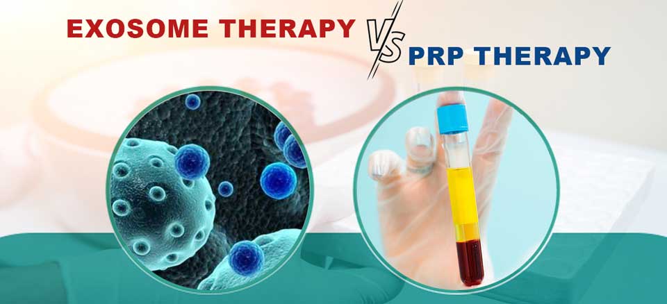 تفاوت اگزوزوم و پی آر پی