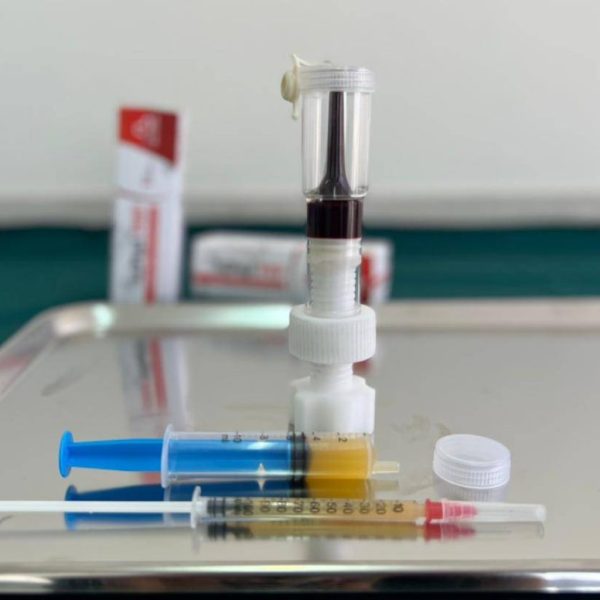 تفاوت prp با L-PRP