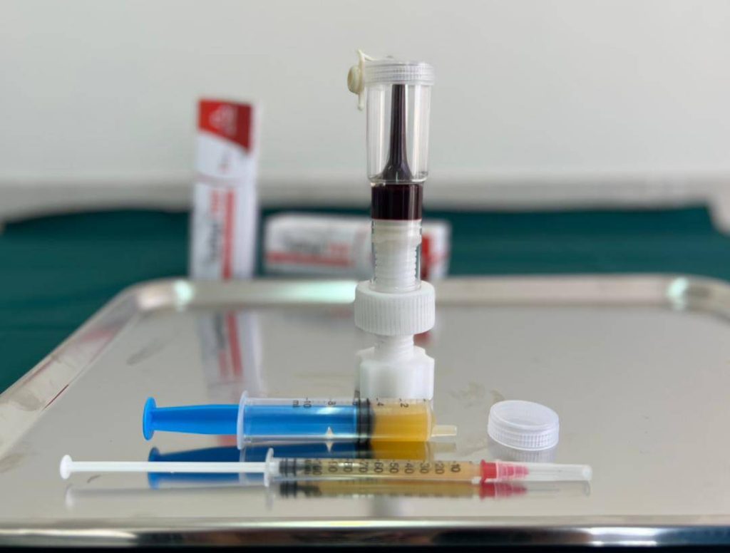 تفاوت prp با L-PRP