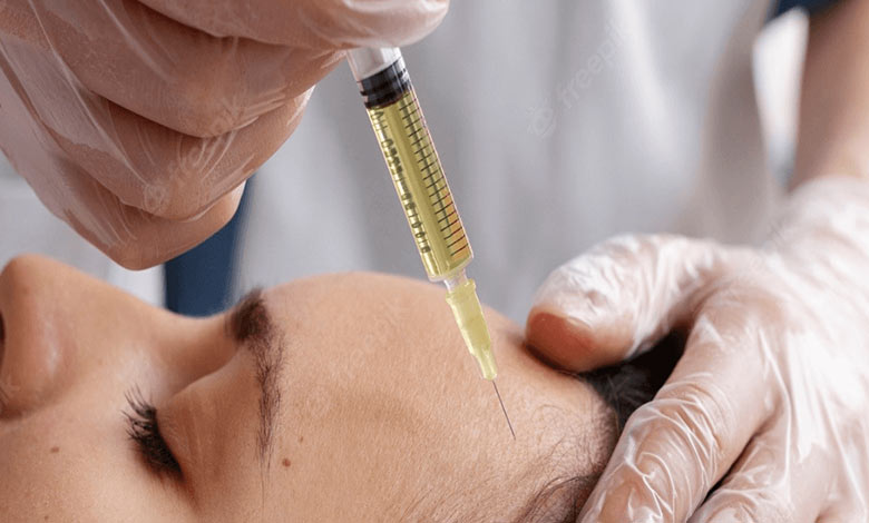 نقش PRP در بهبود زخمهای پوستی