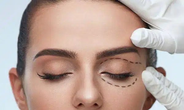 PRP و کاهش پف، خطوط و تیرگی پوست دور چشم بدون جراحی